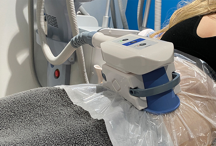 rta-med-cryolipolysis-2-740x500-1